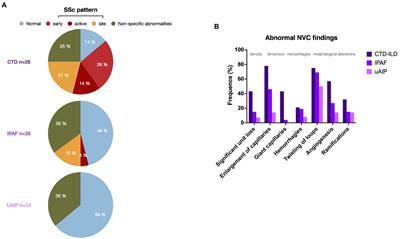 Fine-tuning characterization of patients with interstitial pneumonia and an underlying autoimmune disease in real-world practice: We get closer with Nailfold videocapillaroscopy